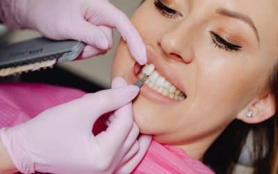 Blanqueamiento dental: mitos, verdades y su papel en el diseño de la sonrisa